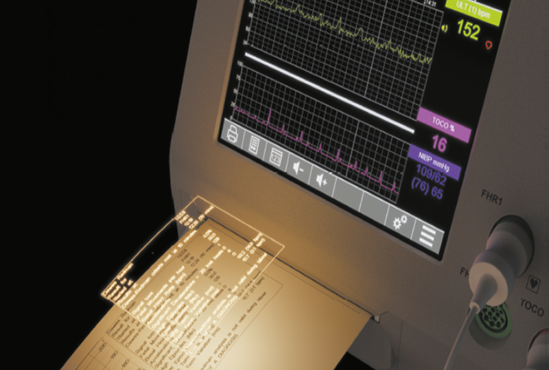 Dawes-Redman CTG Analysis